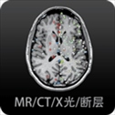 影像解剖图谱